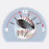 SKY fast & fixed and screw retained bridge abutment - Image 2