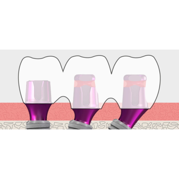 copaSKY exso Multifunctional Abutment