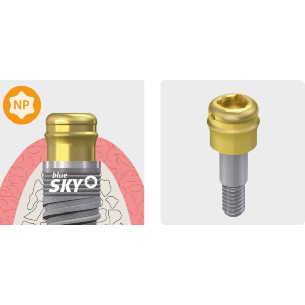 SKY Locator Abutment