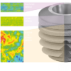 copaSKY - The Ultra Short Implant - Image 3