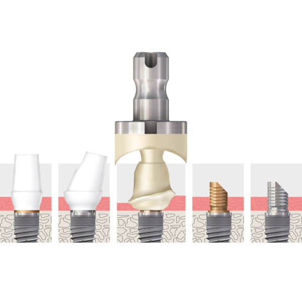 BioHPP SKY elegance abutments